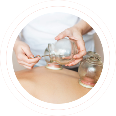 manuelle Therapie: Schröpfen in Friedberg